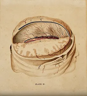Human Brain Cross Section Drucke: Brain: dissection showing a section of the right hemisphere