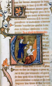 Medical Illustration Art Drucke: Cupping, 14th century