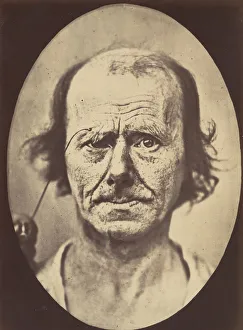 Black And White Photography Heritage Drucke: Figure 12: A study of the contraction of and the expression produced by t