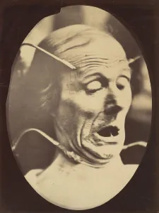Nineteenth Century French Art Drucke: Figure 62: Terror, semiprofile, 1854-56, printed 1862. Creators: Duchenne de Boulogne
