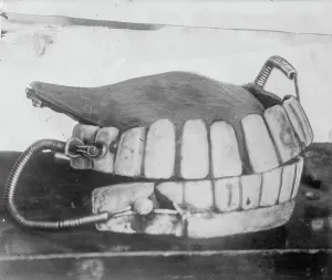 Georges Washingtons Zähne zwischen 1910 und 1915. Ersteller: Bain News Service