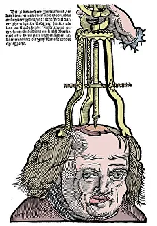 Medical Instrument History Drucke: Trephination, 1593