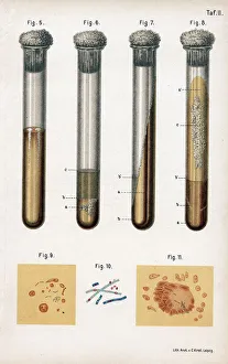 Viele Arten von Bakterien, 1889