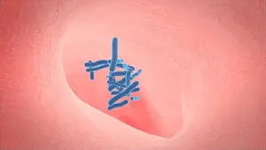 3D-Illustration der Struktur des menschlichen Lungen.pneumonie.Tuberkulose