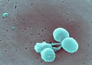 Elektronenmikroskopbild von Streptococcus pneumoniae