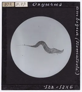 Natural Sciences Photography Drucke: Ambiguous Oxyurus (Nematodea) enlarged under a microscope