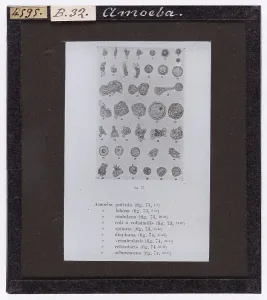 Microbiology Slides Online Drucke: Amoeba enlarged under a microscope
