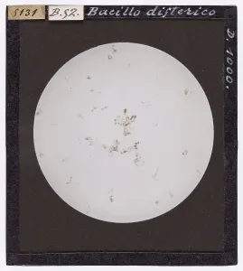 Bacillus diphtheriae unter dem Mikroskop
