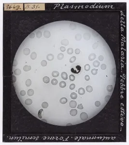 Ein Mikrofotograf von Plasmodium malaria, das bei der Untersuchung mit einem Mikroskop in vergrößerter Form sichtbar ist.