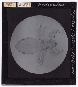 Mathematical And Natural Sciences Images Drucke: Pediculus Capitis (Apteri) enlarged under a microscope