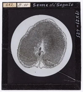 Botany Research Subjects Drucke: Rye seed enlarged under a microscope