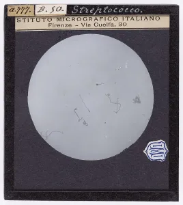 Microbiology Slides Drucke: Streptococco enlarged under a microscope