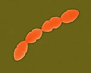 Scanning Electron Microscopy Images Drucke: Coloured scanning electron micrograph (SEM) of Streptococcus pneumoniae
