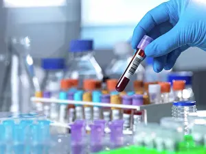Laboratory Analysis Drucke: Medical testing, conceptual image