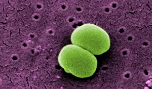 Rasterelektronenmikroskopische Abbildung von Staphylococcus epidermidis.