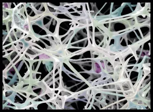 Scanning Electron Microscope Image Drucke: Micro-structure of Magic Eraser material, SEM