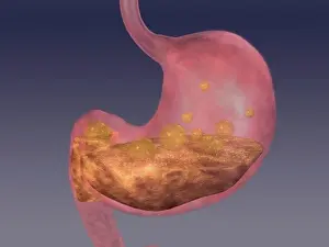 Stomach