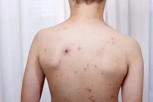 Healthcare System Control Drucke: A child stands with their back facing the camera