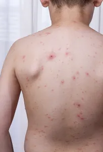 Child Health Issues Drucke: A child stands with their back facing the camera