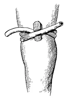 Hygienic Practices Drucke: Elastic constriction of the thigh