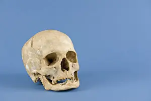 Exposed Studio Photography Drucke: Human skull