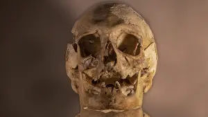 Deserted Graveyard Drucke: Human skull
