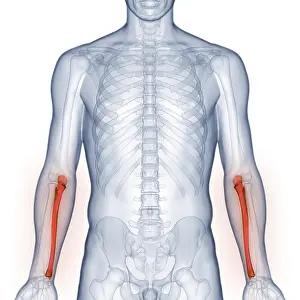 X Ray Examination Drucke: Image converted using ifftoany
