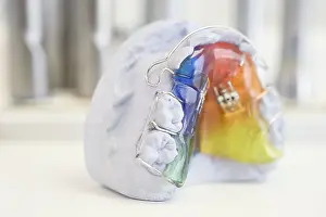 Medical Care In Germany Drucke: Model of dentures on a plaster cast