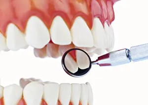 Dentist At Work Drucke: The model of a set of teeth being examined