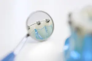 Dental Model Drucke: Detail of a model of teeth with braces