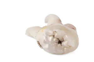 Bright Light Photography Drucke: Pulled wisdom tooth, tooth, carious