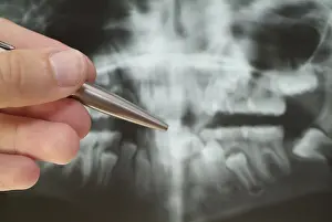 Medical Consultation Drucke: Radiograph
