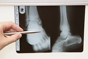 Doctor Patient Conversation Drucke: Radiograph