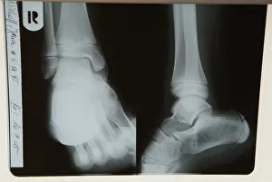 Doctor Patient Conversation Drucke: Radiograph