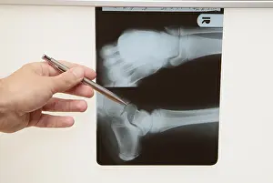 Family Doctor Consultation Drucke: Radiograph