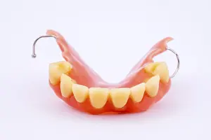 Dental Prosthesis Drucke: Removable denture of an upper jaw