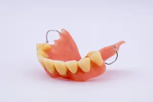 Dental Prosthesis Drucke: Removable denture of an upper jaw