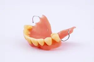 Dental Prosthesis Drucke: Removable denture of an upper jaw