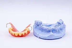 Dentist Treatment Drucke: Removable denture of an upper jaw