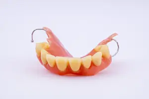 Dental Prosthesis Drucke: Removable denture of an upper jaw