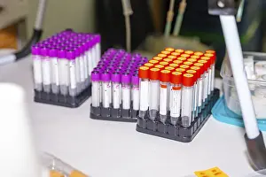Blood Test Results Drucke: Samples of blood labeled on a table with no people