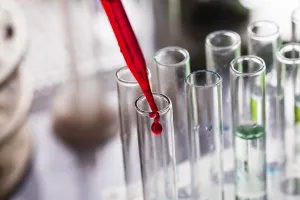 Biotechnology Research Drucke: Scientist shows a diffusion in the Petri dish
