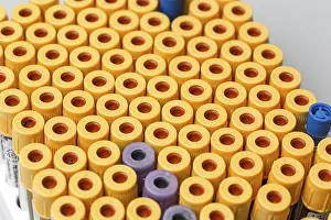Scientific Research Tools Drucke: Set of Test tubes in the laboratory