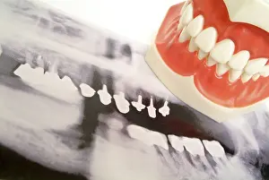 Dentist Treatment Drucke: Tooth x-ray