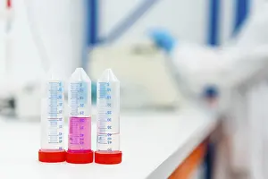 Healthcare Professionals At Work Drucke: Three tubes with samples in the table of a laboratory with someone working on the background