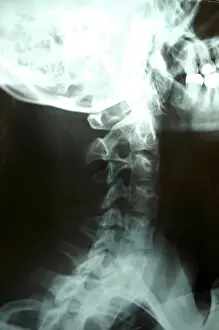 X-ray