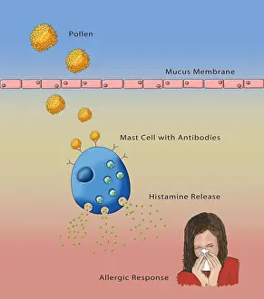Pollen Allergy Symptoms Drucke: Allergic Response, Illustration
