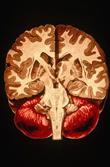 Human Brain Anatomy Drucke: Brain, Coronal Section