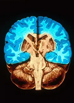 Human Brain Anatomy Drucke: Brain, Coronal Section