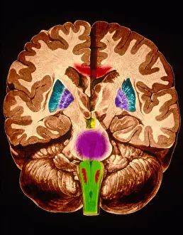 Human Nervous System Drucke: Brain, Coronal Section